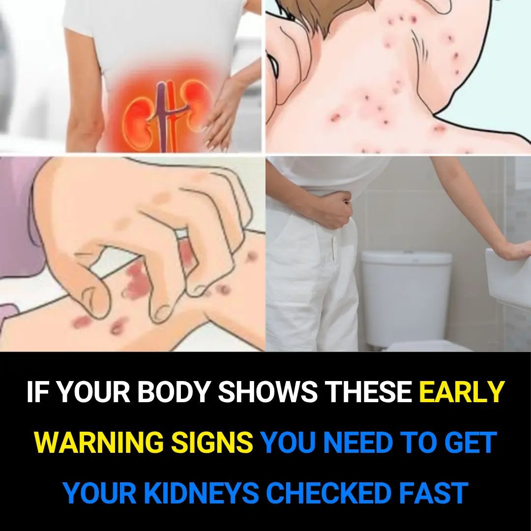 The Silent Threat: Recognizing Early Signs of Kidney Disease and Lifestyle Prevention