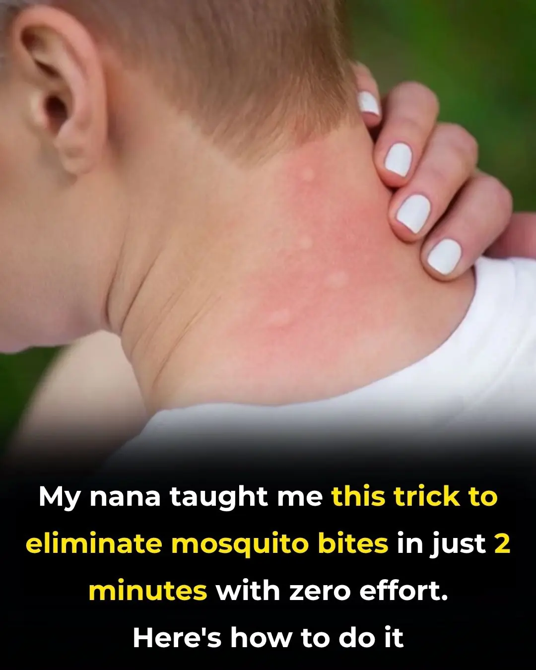 Find Eliminate Mosquito Bites in Just 2 Minutes with Zero Effort