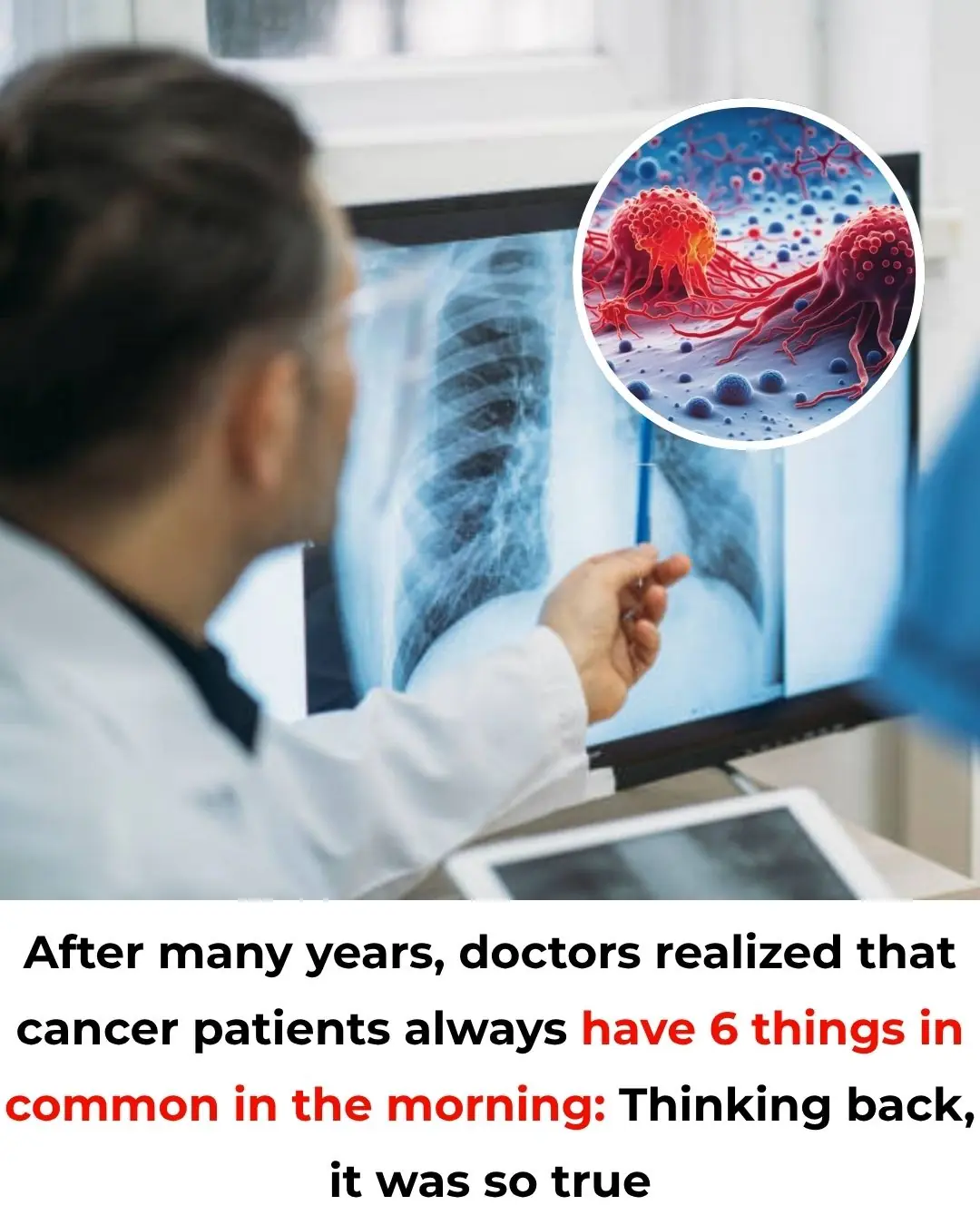 After many years, doctors realized that cancer patients always have 6 things in common in the morning: Thinking back, it was so true