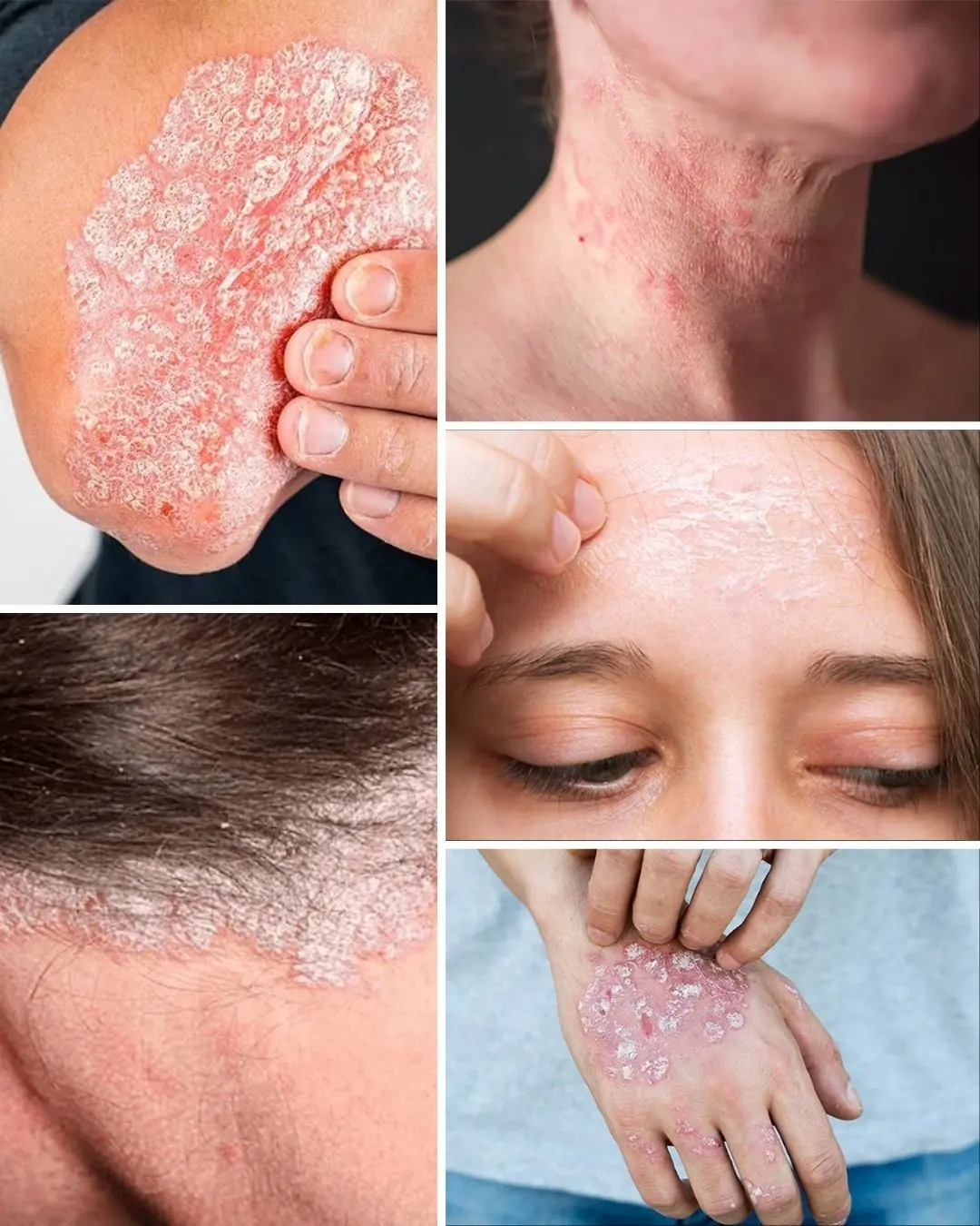 Signs you should know if you have this thing called…