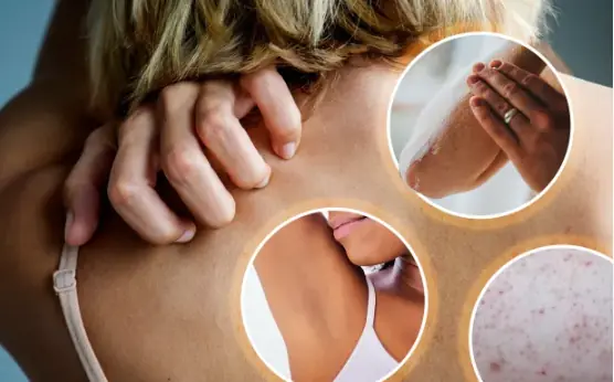 12 Surprising Skin Changes That May Signal Diabetes (A Must-Know Guide)