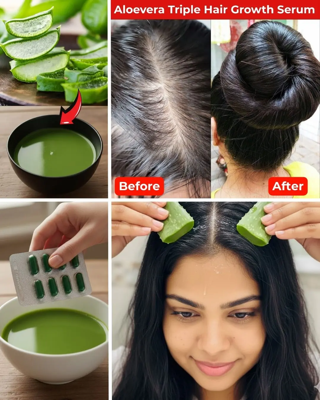 DIY Aloevera Oil for Hair Growth – Get Thick Hair