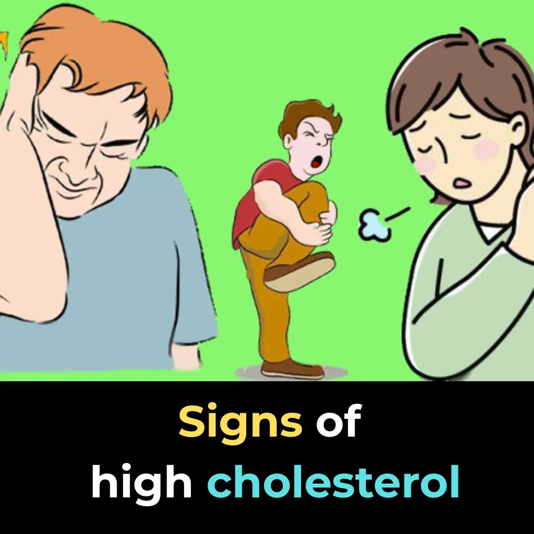 Signs and Symptoms That May Indicate High Cholesterol Levels
