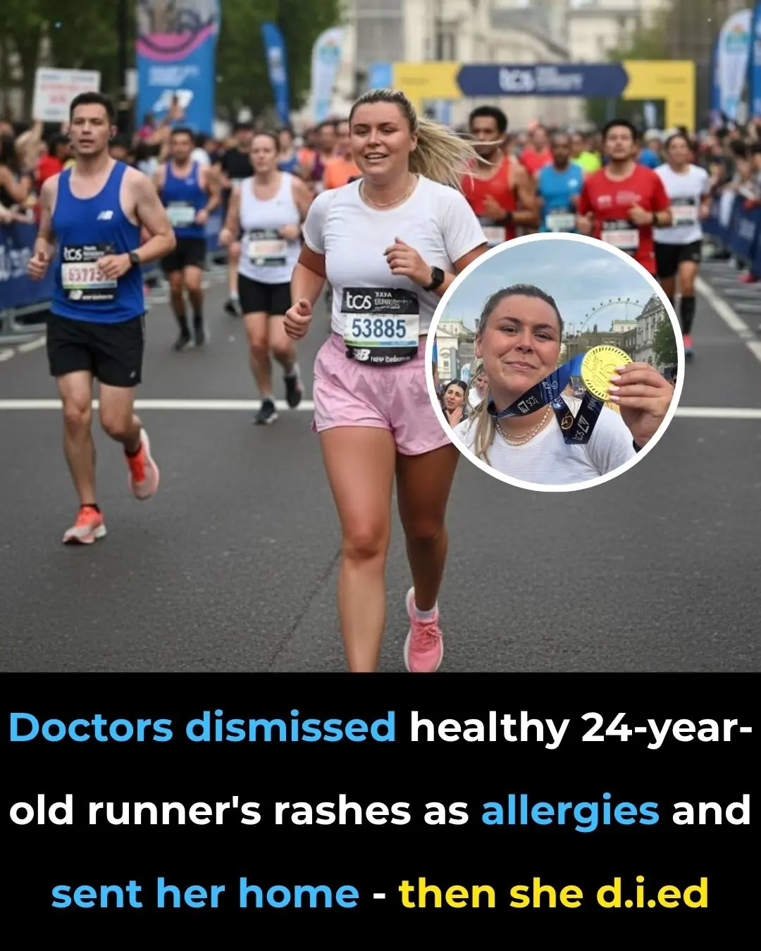 Doctors dismissed healthy 24-year-old runner’s rashes as allergies and sent her home — then she died