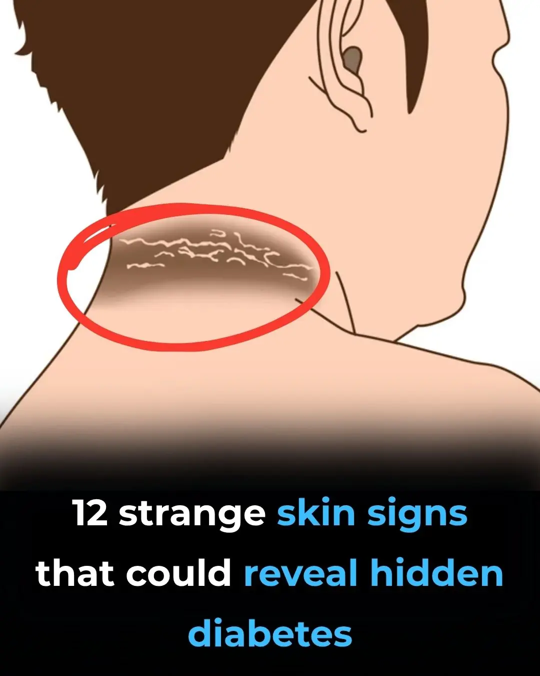 12 Weird Diabetes Skin Problems You Need To Know
