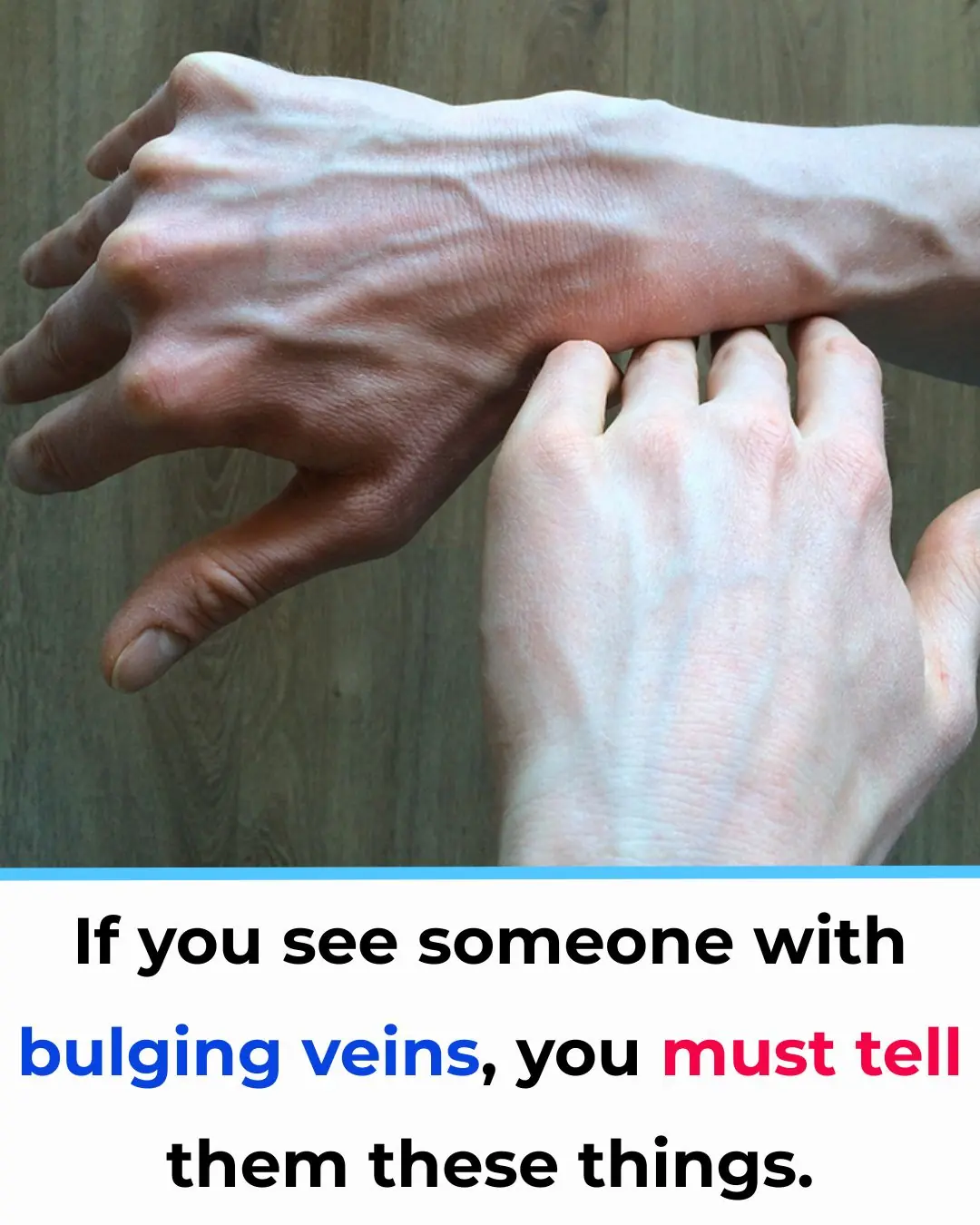 If You See Someone With Prominent Blue Veins, You Definitely Need to Tell Them This—It Could Save Their Life