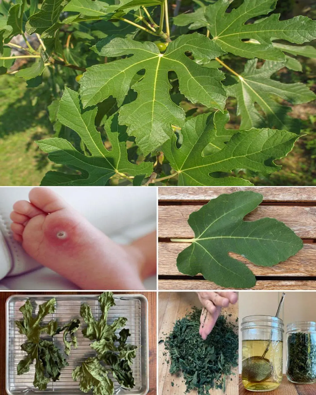 Fig Leaves: Surprising Benefits and Uses