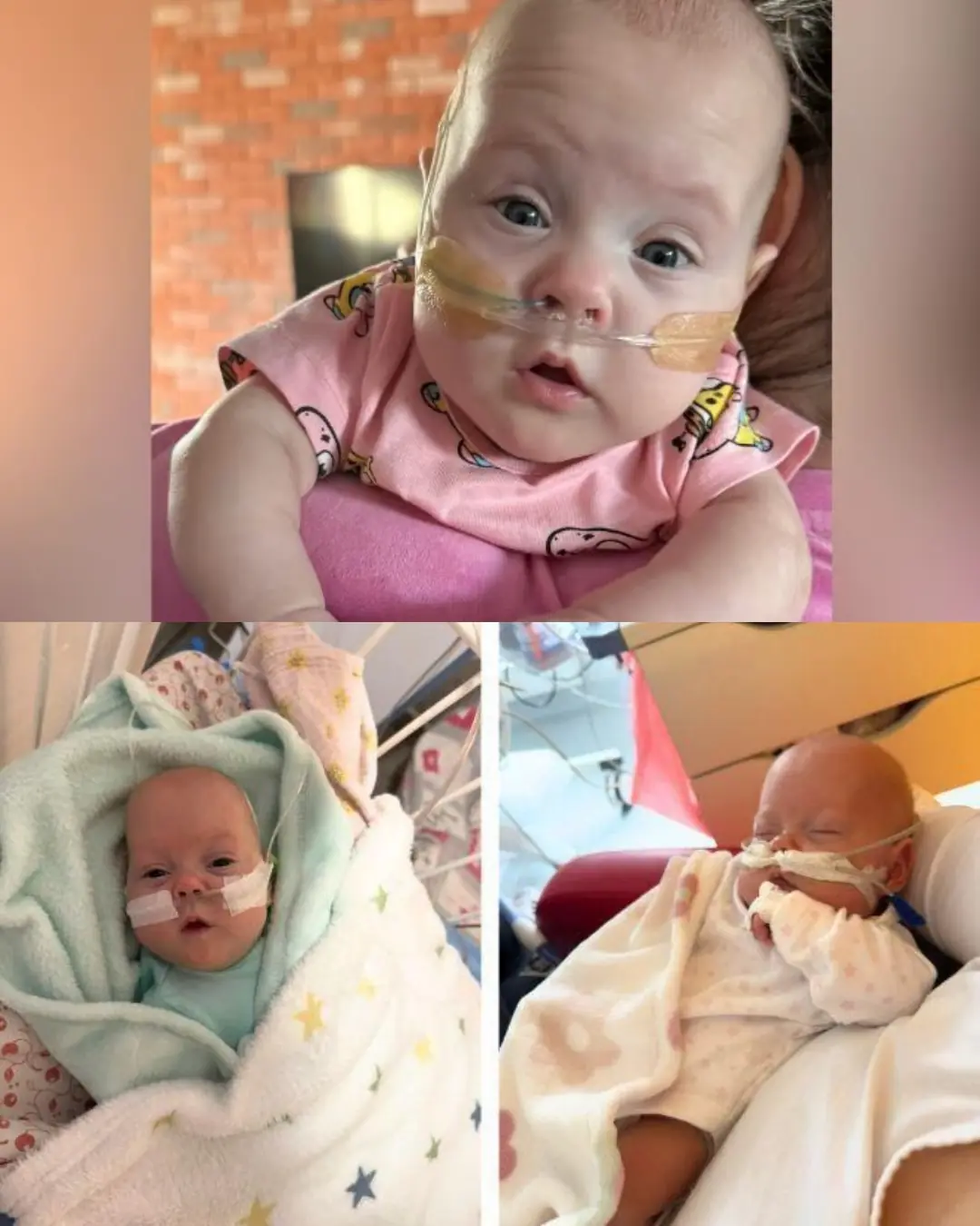 Michalinka’s Fight for Life: A Tiny Warrior Who Won’t Give Up