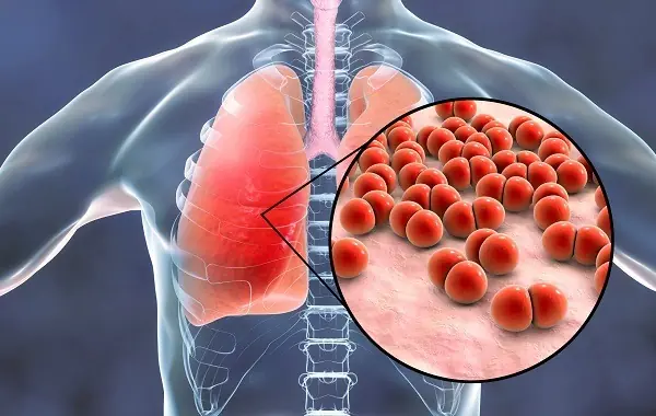 Lung Disease Starts Silently – Spot These Early Signs Before It’s Too Late