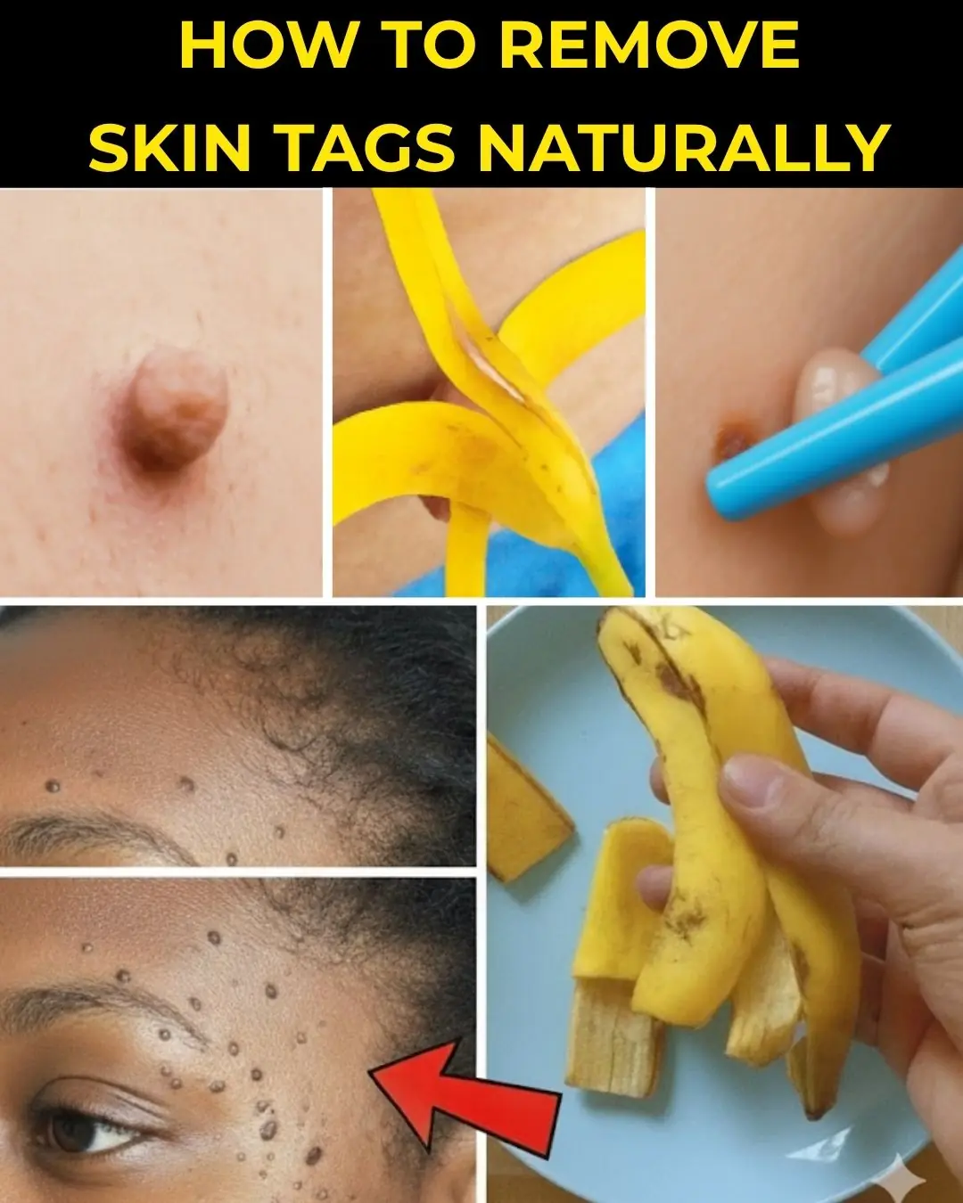 Unlock the Hidden Power of Banana Peels for Radiant, Youthful Skin