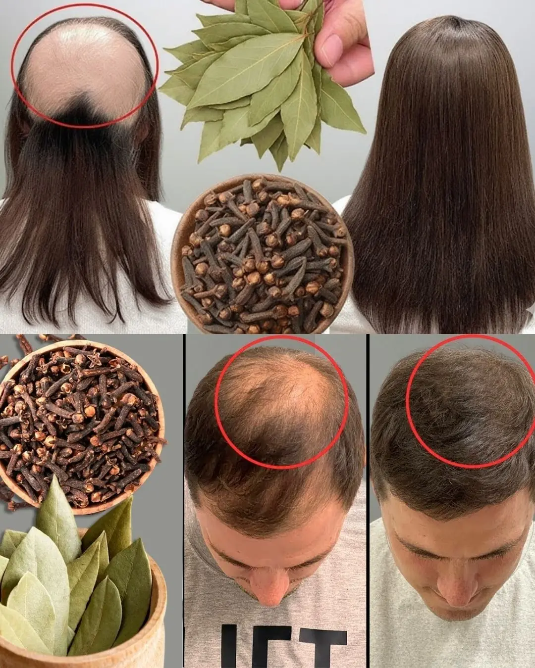 “This 2-Ingredient Hack May Trigger Hair Regrowth in Just 30 Days!”