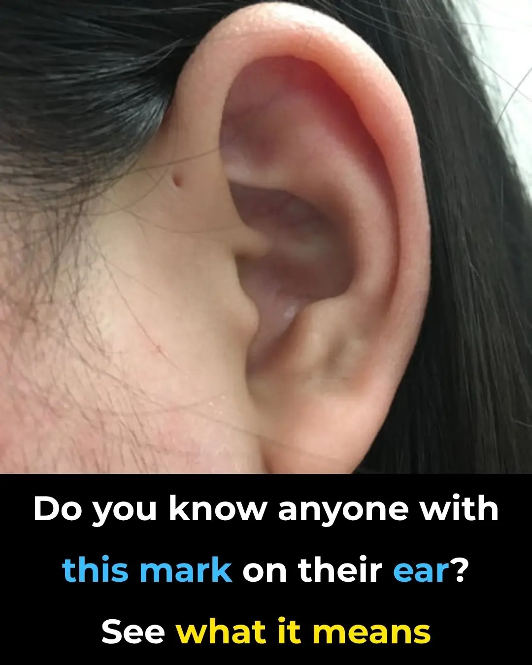 Here is what this little hole on the ear mean