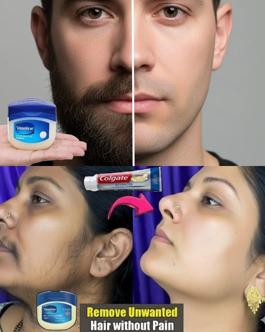 Stop! Shaving Is Not the Only Way – Remove Facial & Body Hair Painlessly with Vaseline