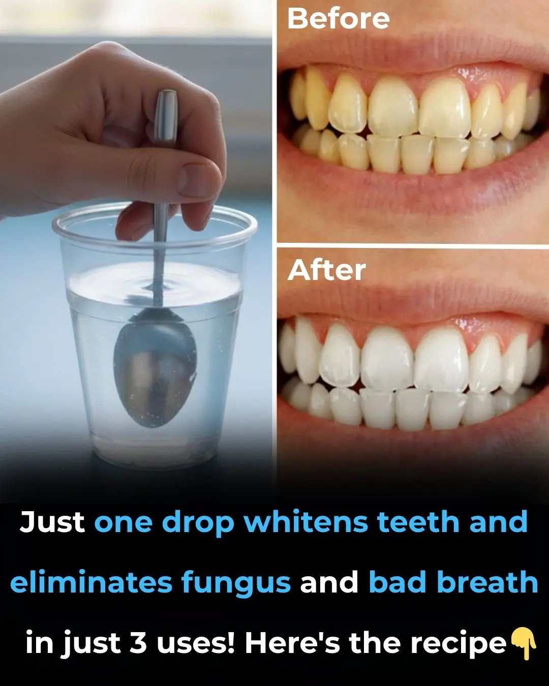 How to Prevent Tartar Build-Up & Keep Teeth Naturally Whiter – A Dentist-Approved Guide