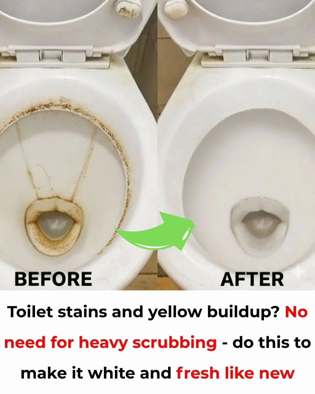 Toilet Bowl Covered in Yellow Stains? You Don’t Need to Scrub Hard — Use These Simple Tricks to Make It Sparkling Again