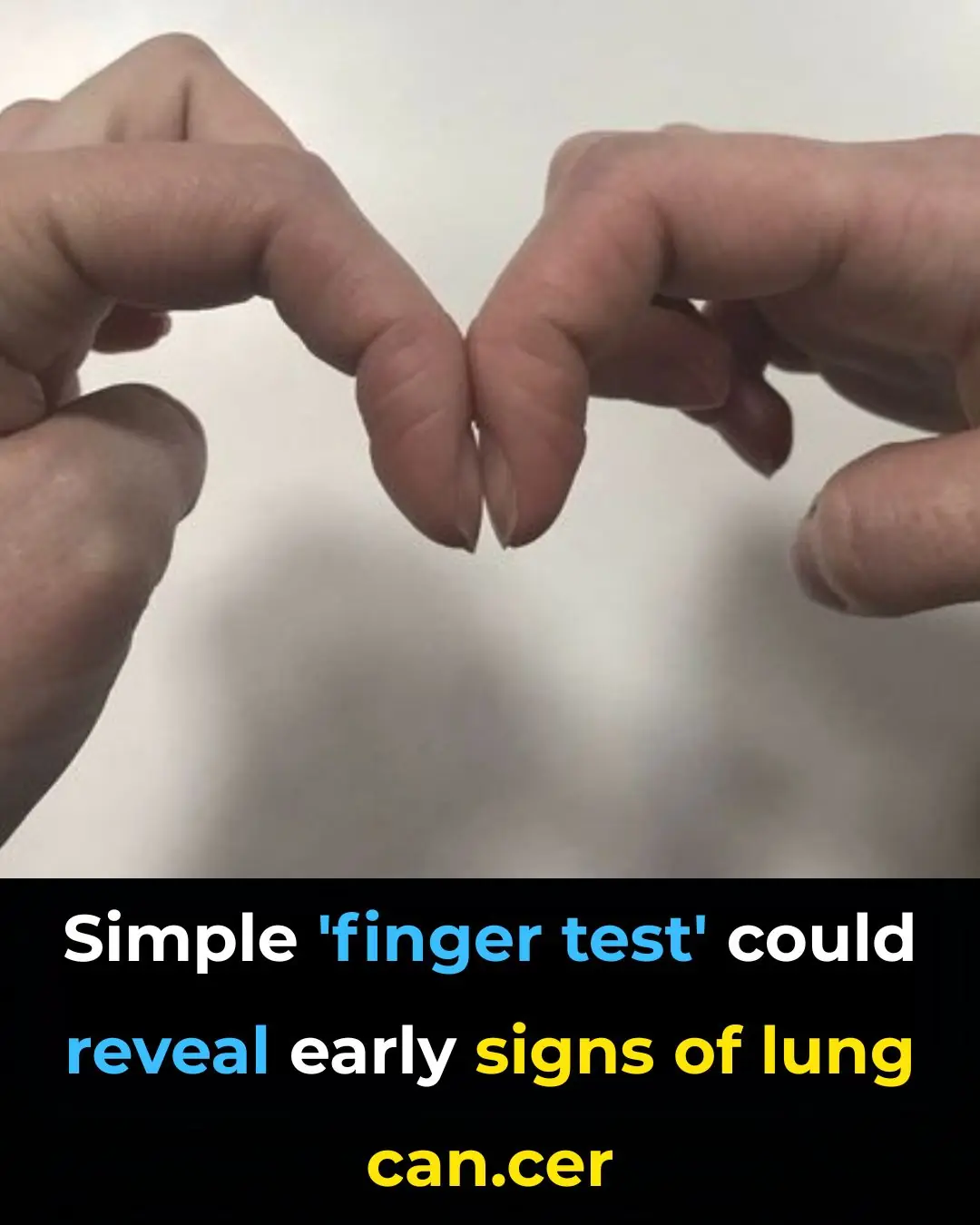 Simple ‘Finger Test’ Could Reveal Early Signs of Lung Cancer — Check Yours at Home