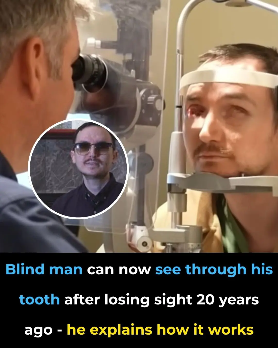 Rare Surgery Helps Man See Again After Losing Vision for Twenty Years Using His Own Tooth
