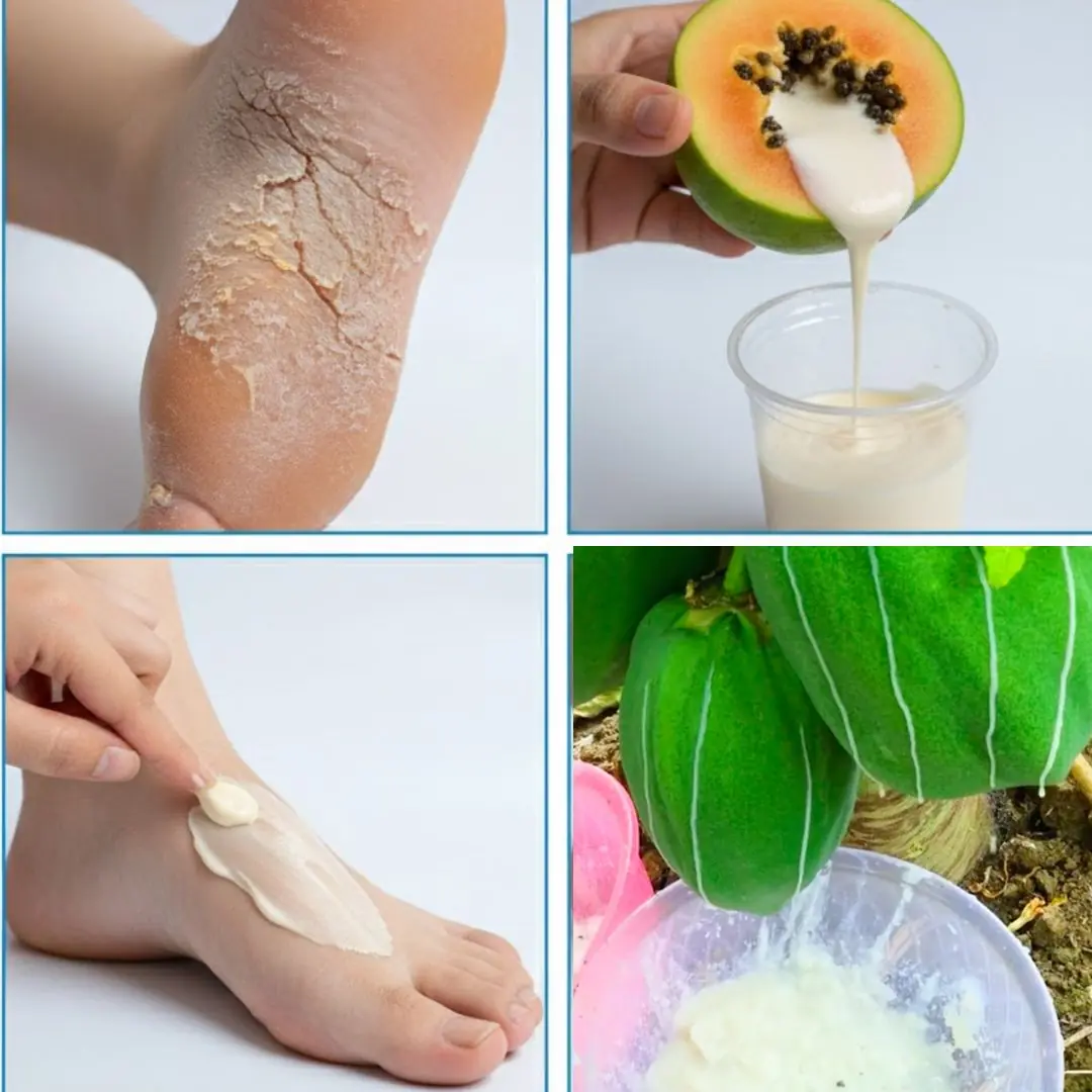 Everyone loves papaya, but most people don't realize how important its sap is... 💬👀👇