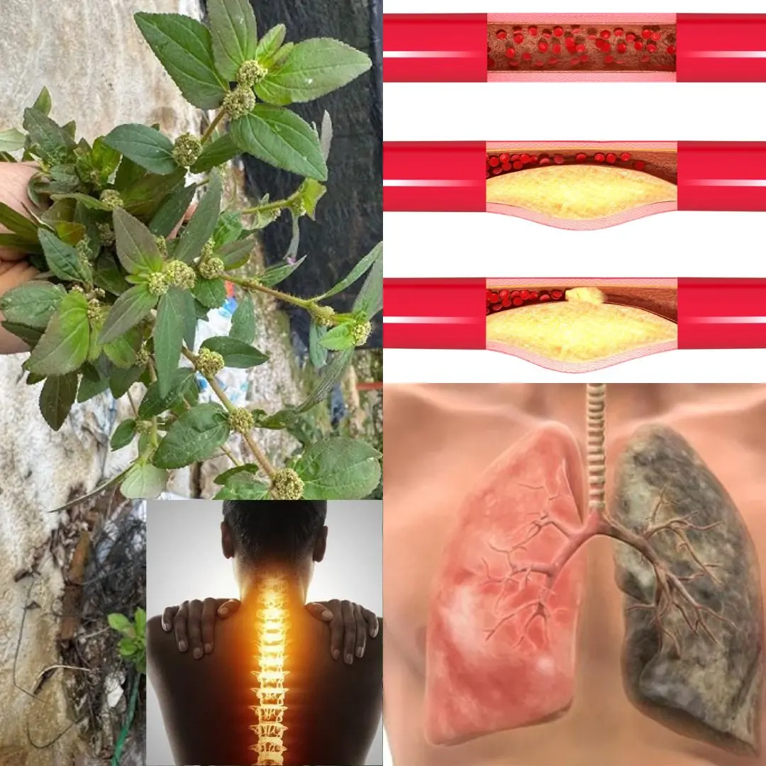 Euphorbia Hirta: 9 key health benefits of this versatile plant