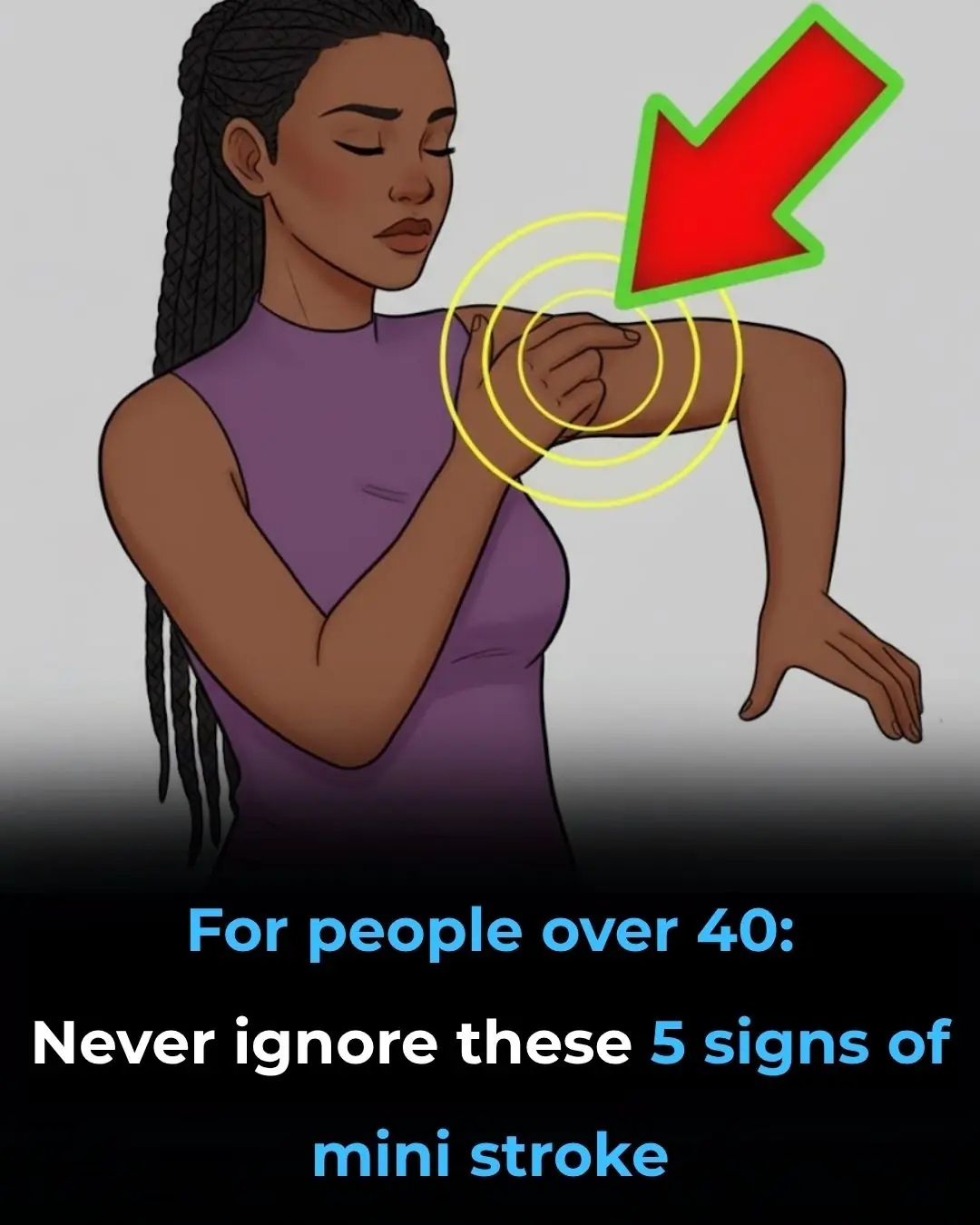 Mini Stroke in People Over 40