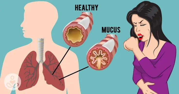 Flush Mucus From Your Body With These Highly Effective Home Treatments