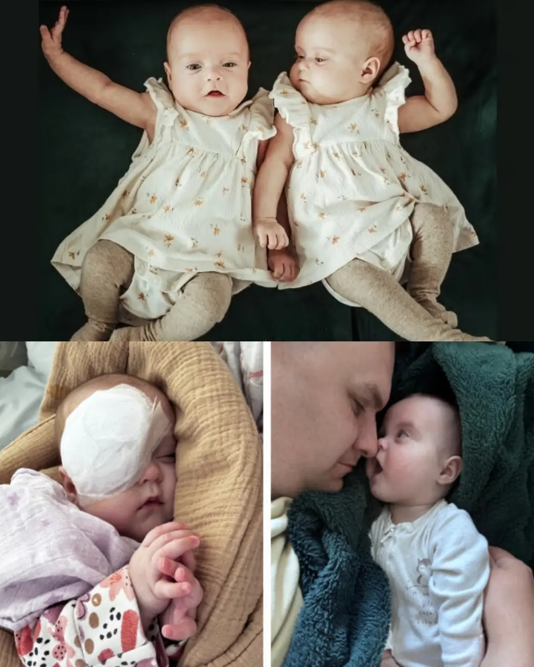 Fighting for Janinka’s Sight: A Family’s Journey Through Premature Challenges