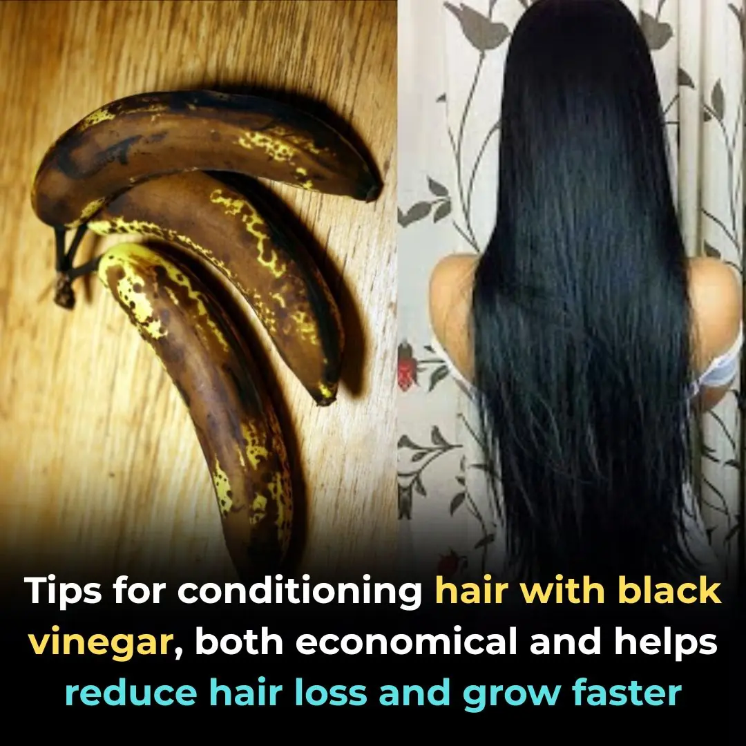 Tips for conditioning hair with black vinegar, both economical and helps reduce hair loss and grow faster