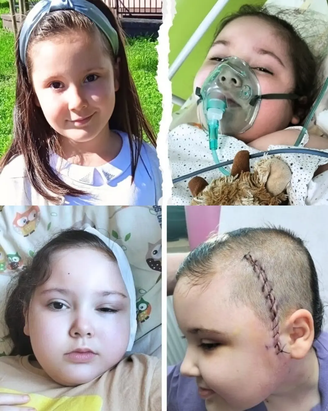 Marysia: A Brave Little Girl Fighting for a Seizure-Free Childhood
