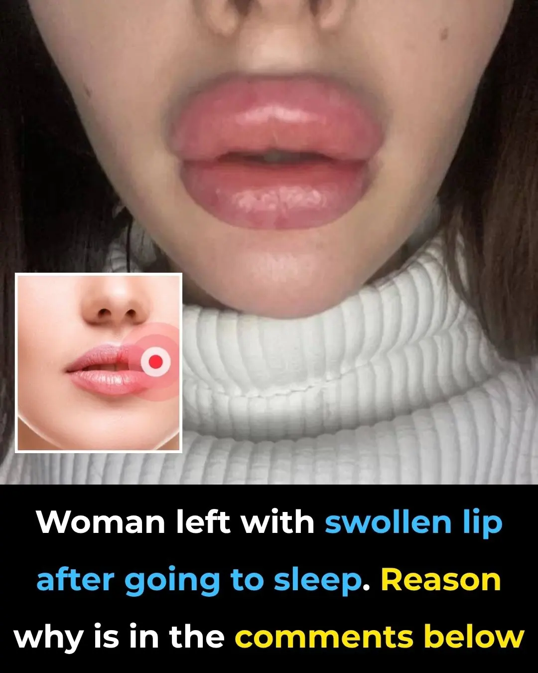 Woman Left with Swollen Lip After Centipede Bites Her in Sleep