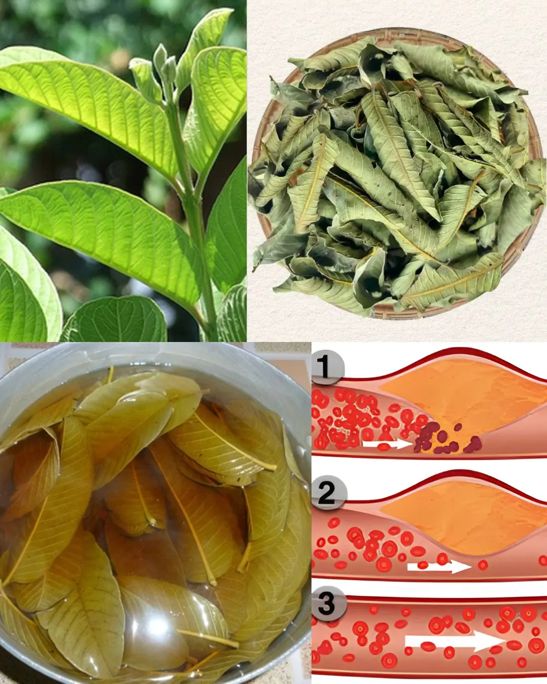 Guava Leaves for Blood Sugar Control: Nature’s Gift for Diabetics