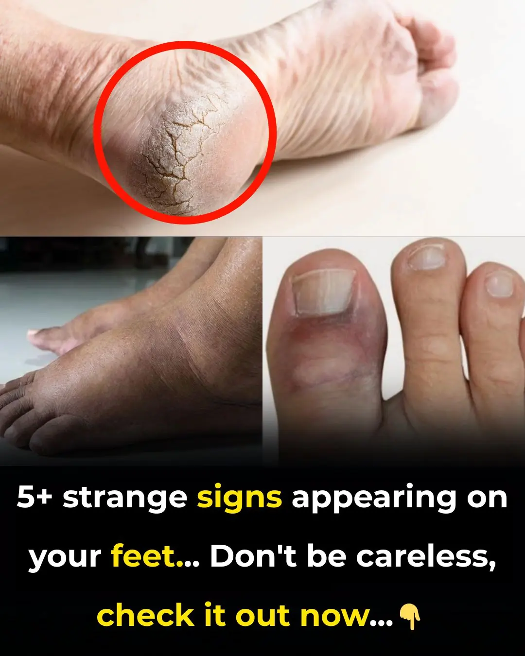 5+ Things Your Feet Can Reveal About Your Health (That You Shouldn’t Ignore)