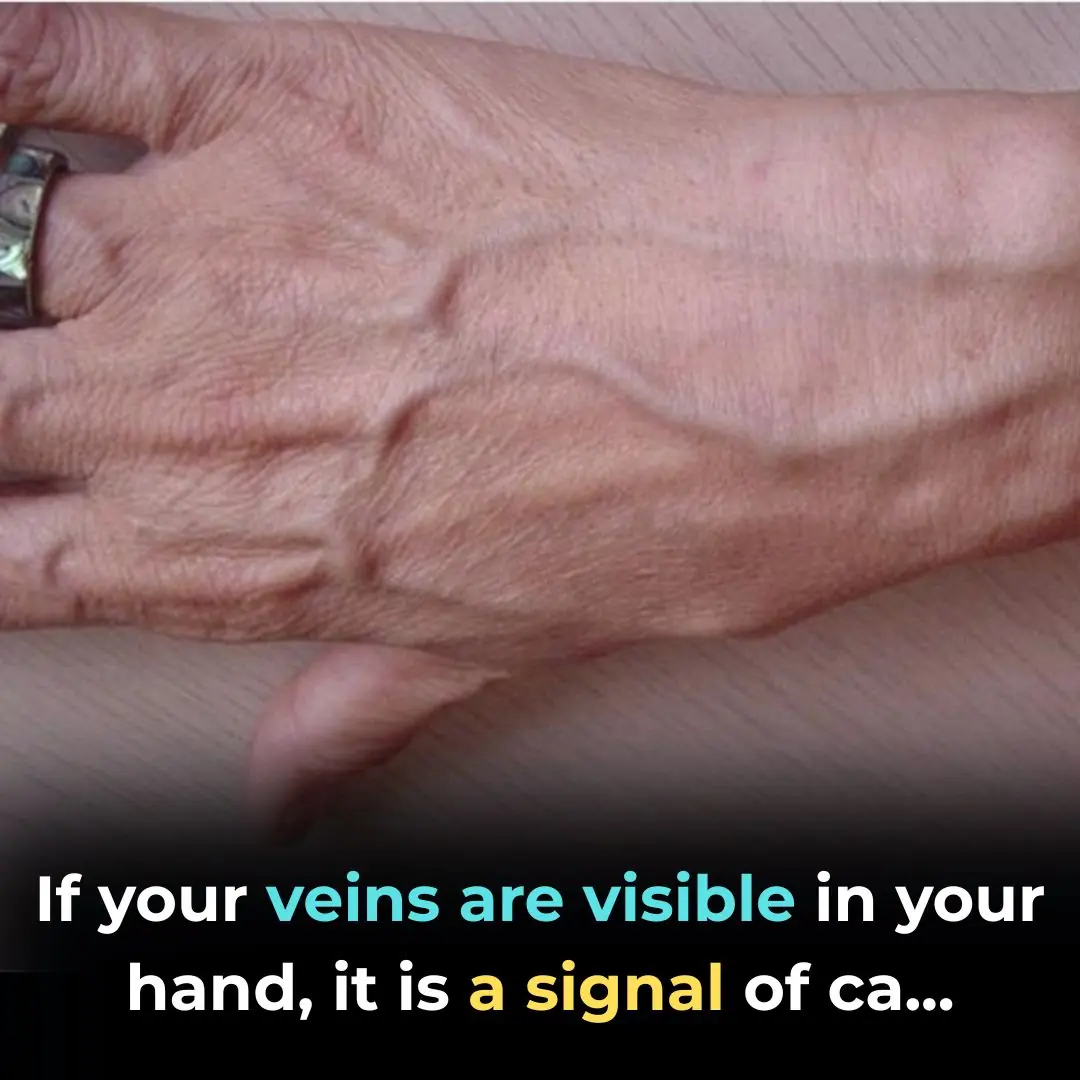 Visible Veins Explained: Normal Causes, Health Risks, and When to Worry