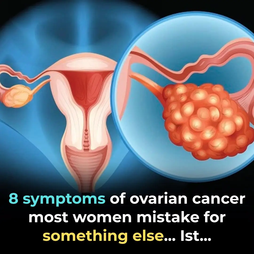 Top 8 Warning Signs of Ovarian Cancer Women ABSOLUTELY Need to Know