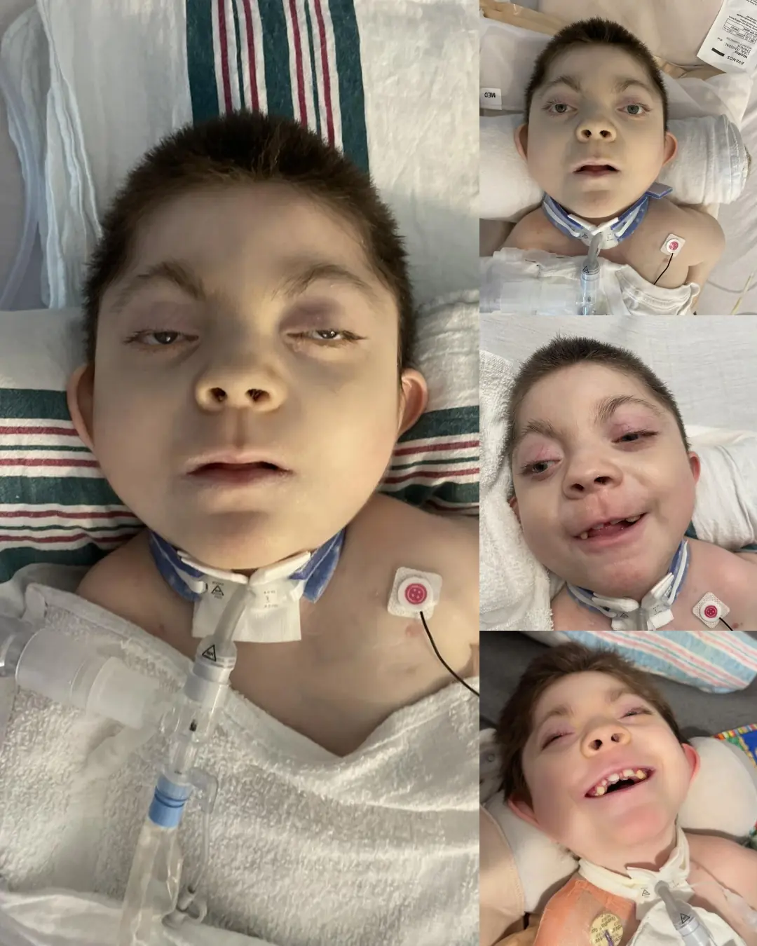 Rayland’s Battle — A Little Fighter’s Ongoing Journey Through Hope and Healing