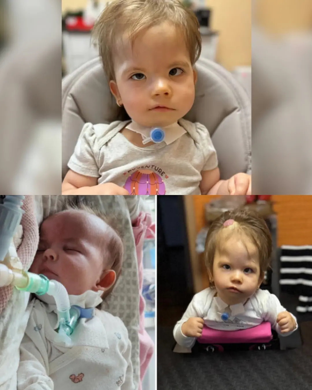 Pola’s Breath of Courage: A Family’s Unbreakable Hope