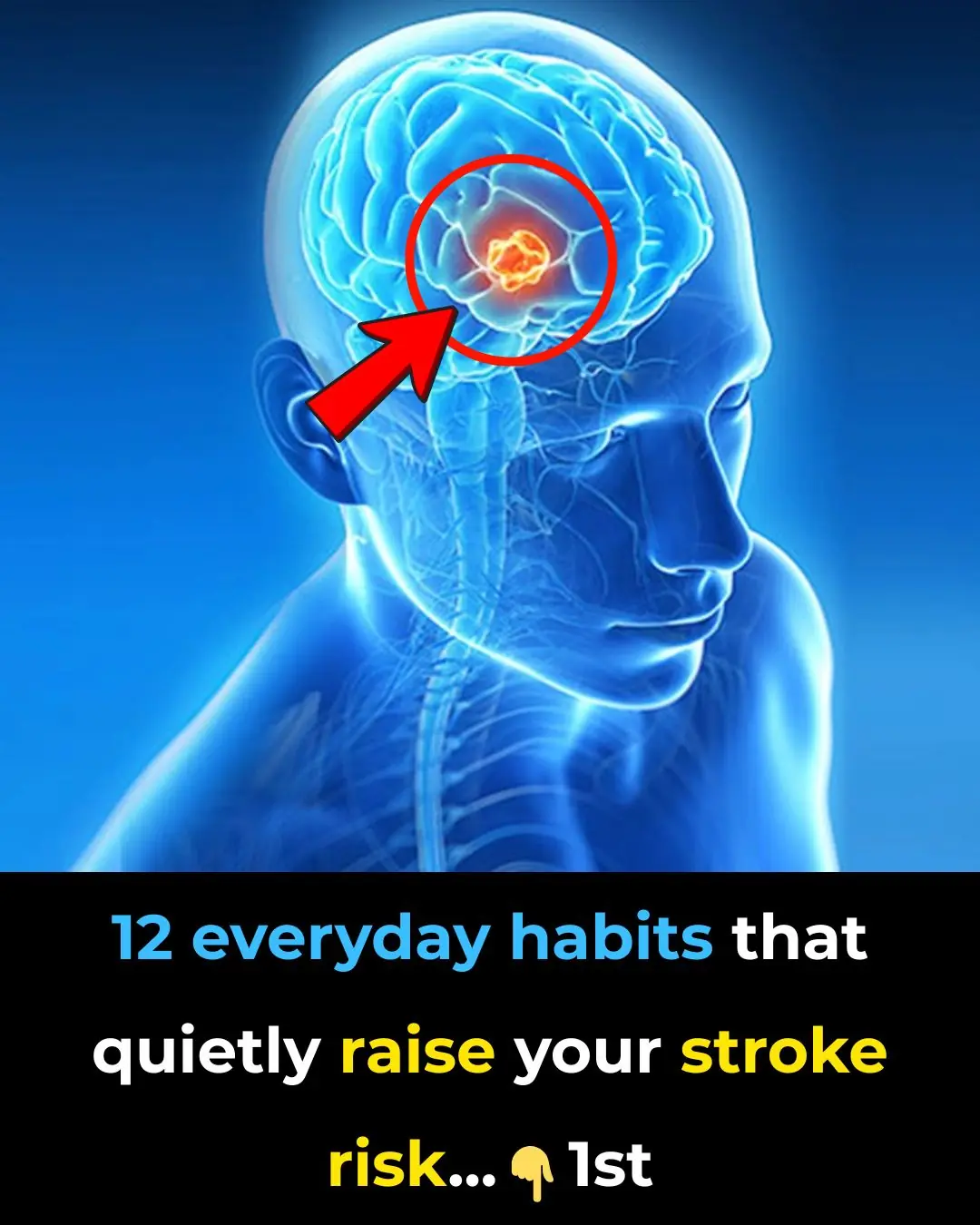 12 everyday habits that quietly raise your stroke risk