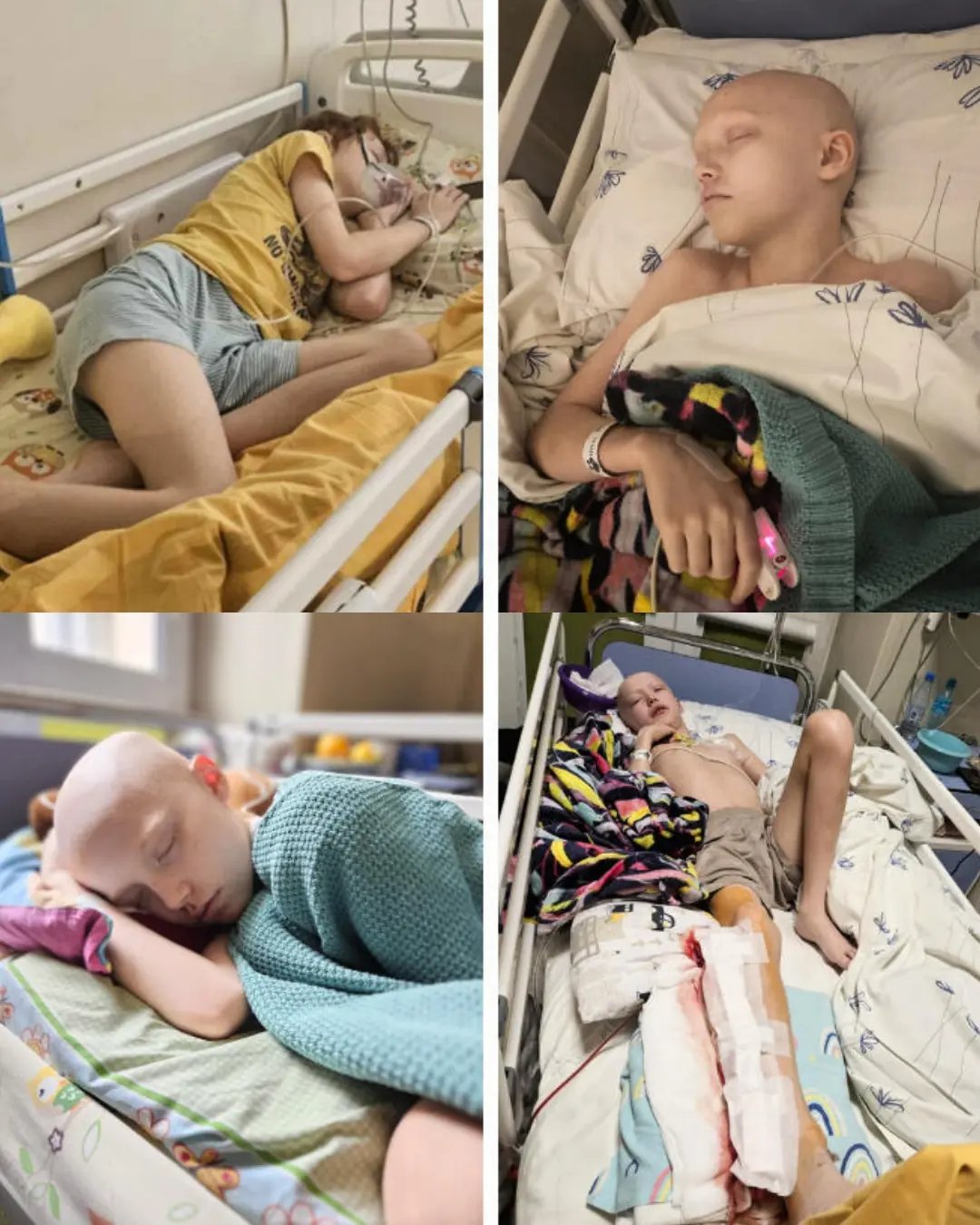 A Mother’s Plea – Krzyś’s Courageous Battle Against Ewing’s Sarcoma