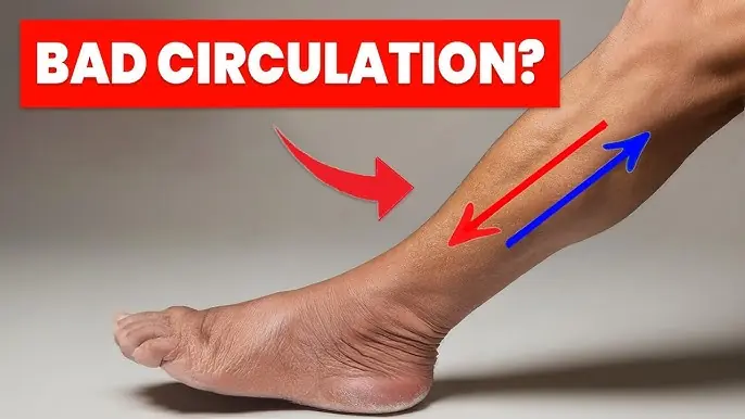 The 3:3:10 Method: 3 Exercises to Improve Leg Circulation