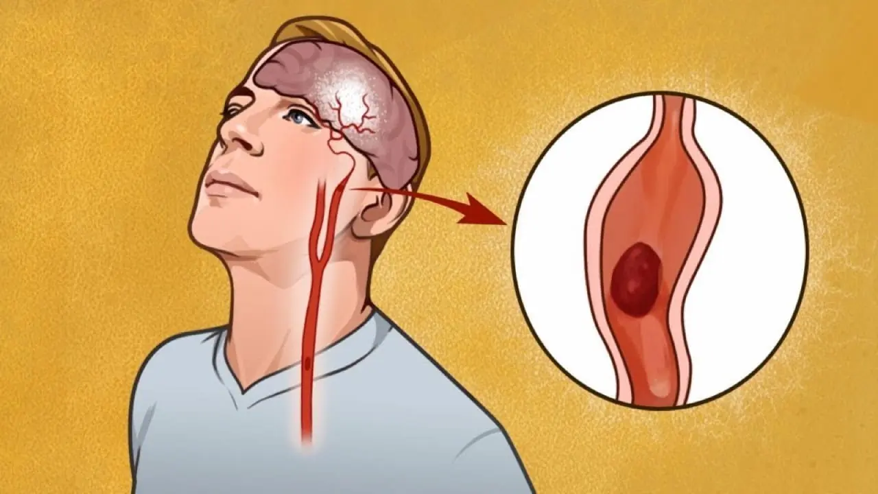 Warning Signs of Poor Blood Circulation You Can’t Afford to Miss
