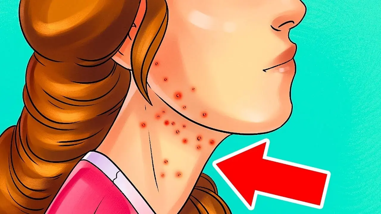 10 Urgent Warning Signs You’re Eating Too Much Sugar