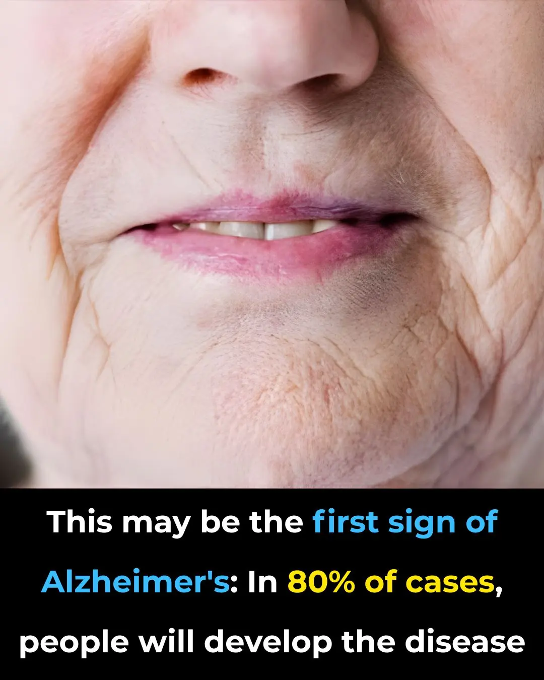 This may be the first sign of Alzheimer’s