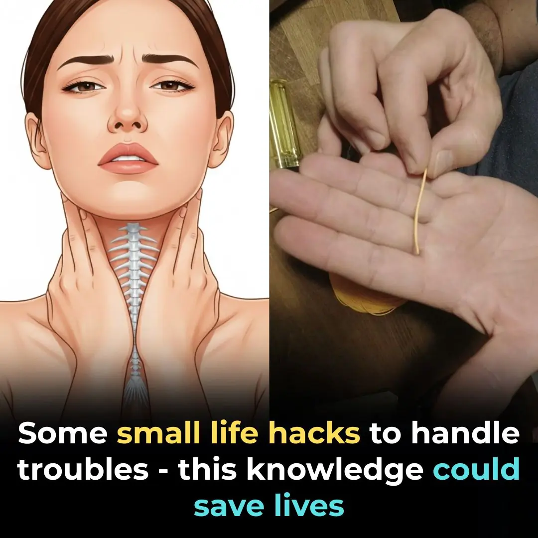 Everyday Emergencies: Small Tips That Could Save a Life