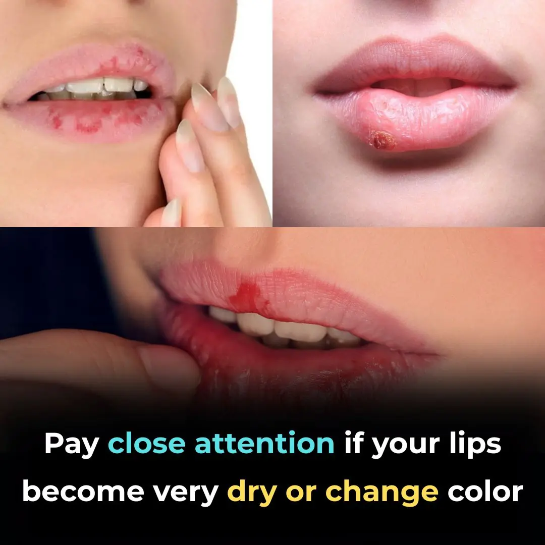 What Your Lips Say About Your Health