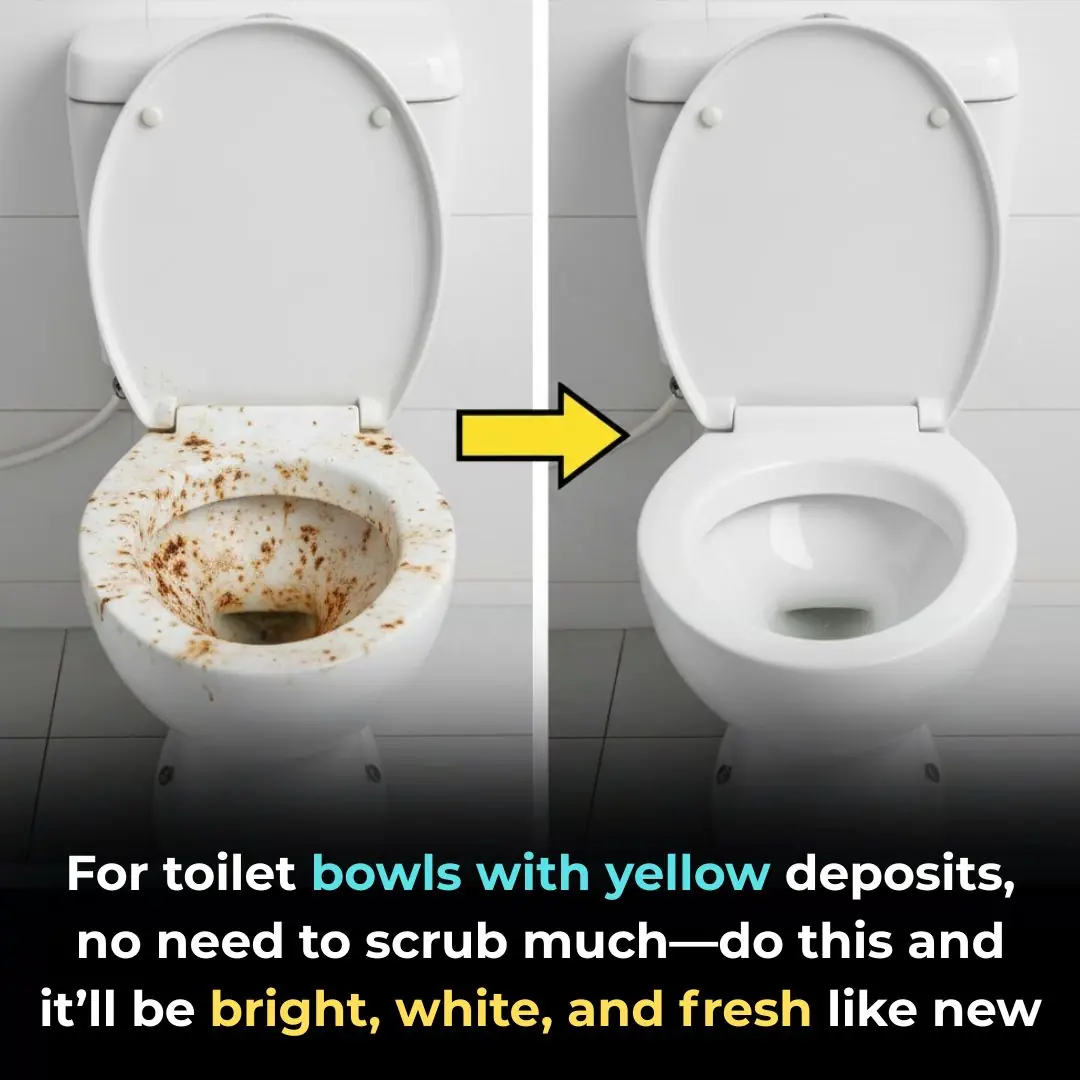 Toilet Stained With Yellow Scale? No Heavy Scrubbing Needed — Try These Natural Tricks for a Sparkling, Fresh Bathroom