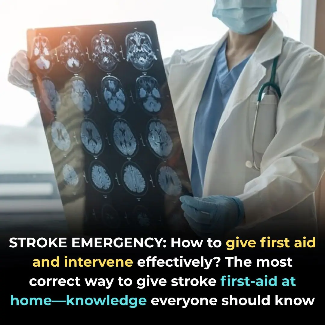 How to Perform First Aid for Stroke at Home — The Right Way to Save a Life