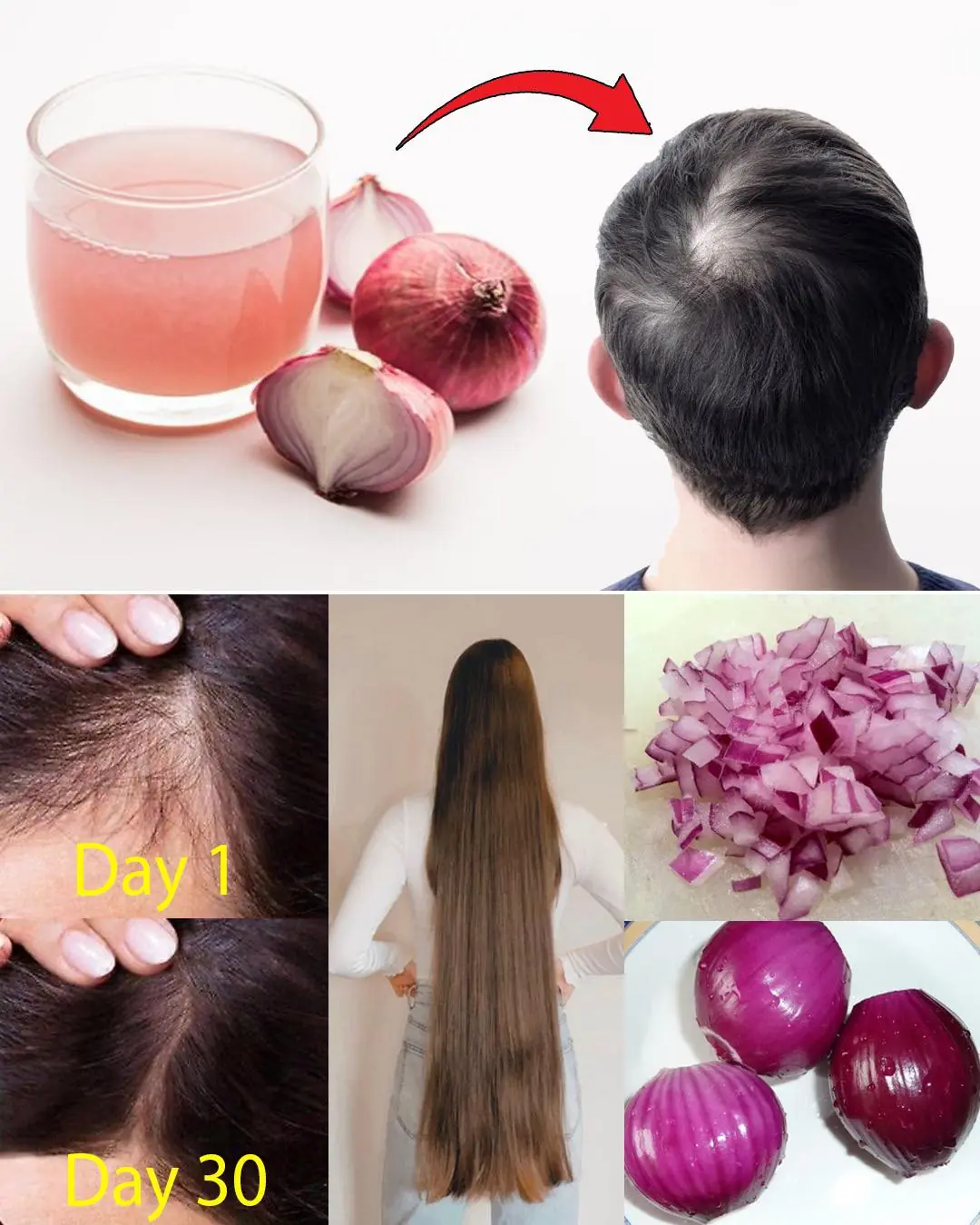 Red Onion for Hair Growth: How This Overlooked Natural Remedy Can Stop Hair Fall and Boost Thickness Fast