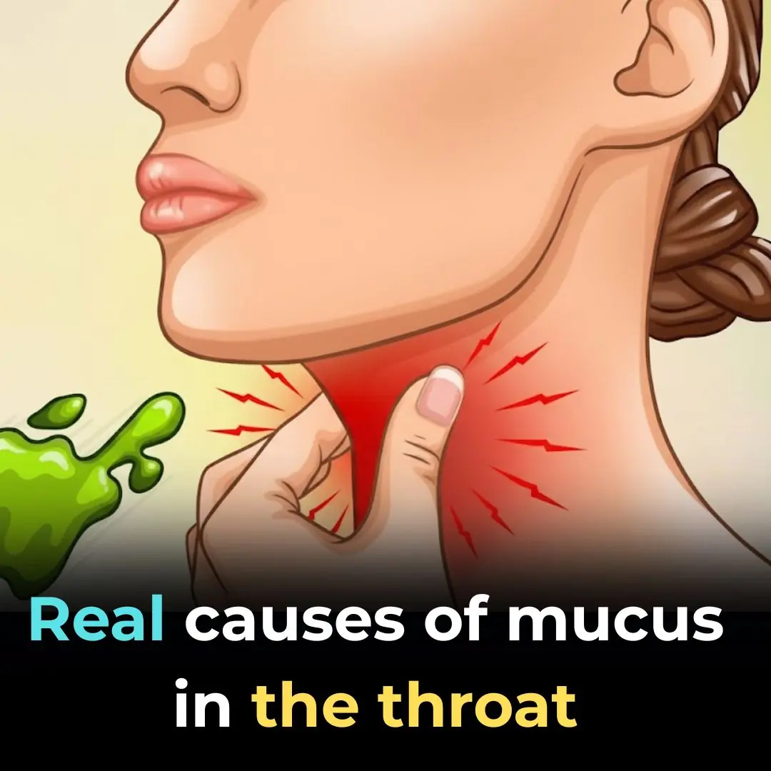 🤢 The Real Causes of Constant Phlegm & Mucus in Throat — And How to Find Relief