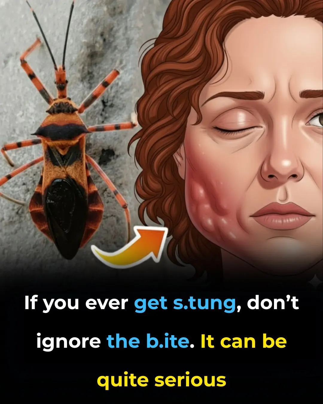 Kissing Bugs and Chagas Disease: A Hidden Danger at Home