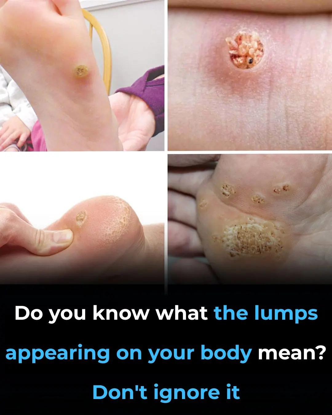 Be Very Careful: If You Notice This Growth on Your Skin, It Could Be Something Serious