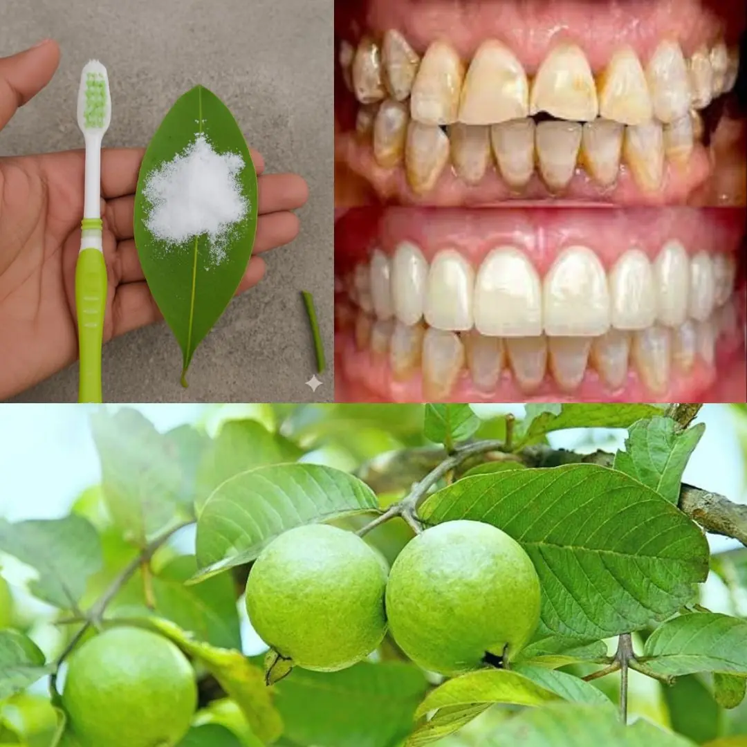 Top 3 Natural Remedies for Tooth Decay Using Guava Leaves